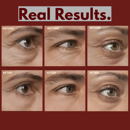 Eye Bag Firming Eraser